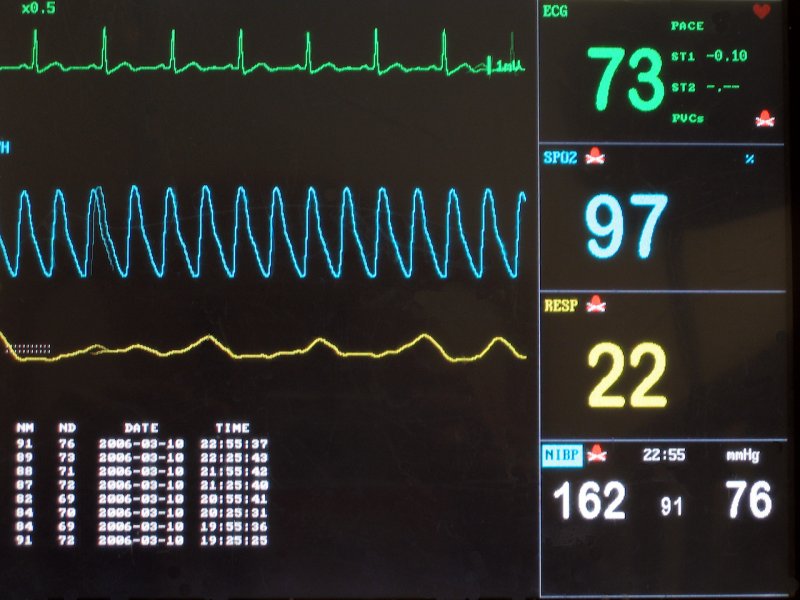 Diagnostické a monitorovací přístroje